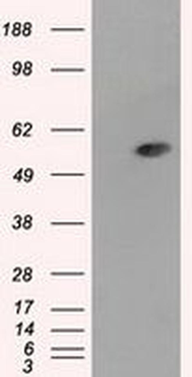 ALDH3A1 Antibody in Western Blot (WB)