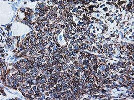 ALDH3A2 Antibody in Immunohistochemistry (Paraffin) (IHC (P))