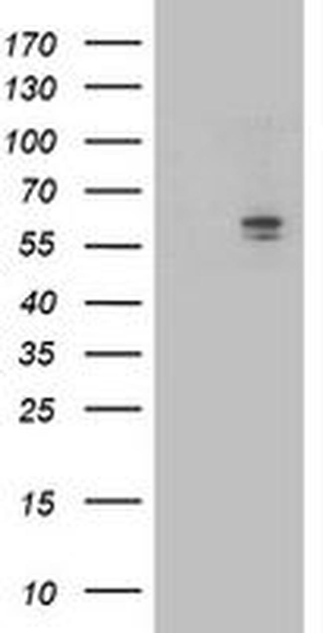 ALDH3A2 Antibody in Western Blot (WB)