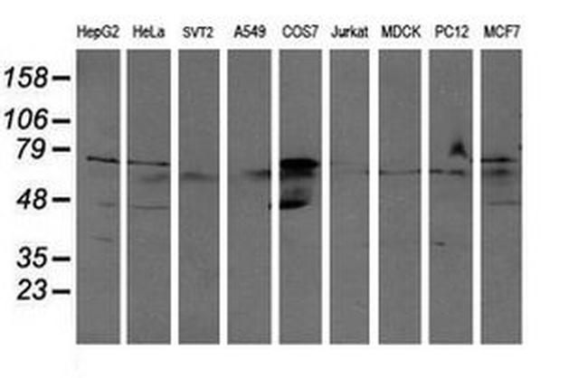 ALDH3A2 Antibody in Western Blot (WB)