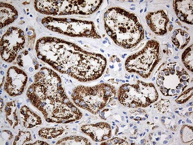 ALDH4A1 Antibody in Immunohistochemistry (Paraffin) (IHC (P))