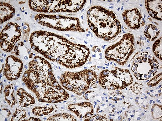 ALDH4A1 Antibody in Immunohistochemistry (Paraffin) (IHC (P))