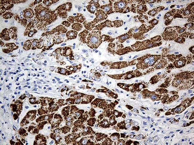 ALDH4A1 Antibody in Immunohistochemistry (Paraffin) (IHC (P))