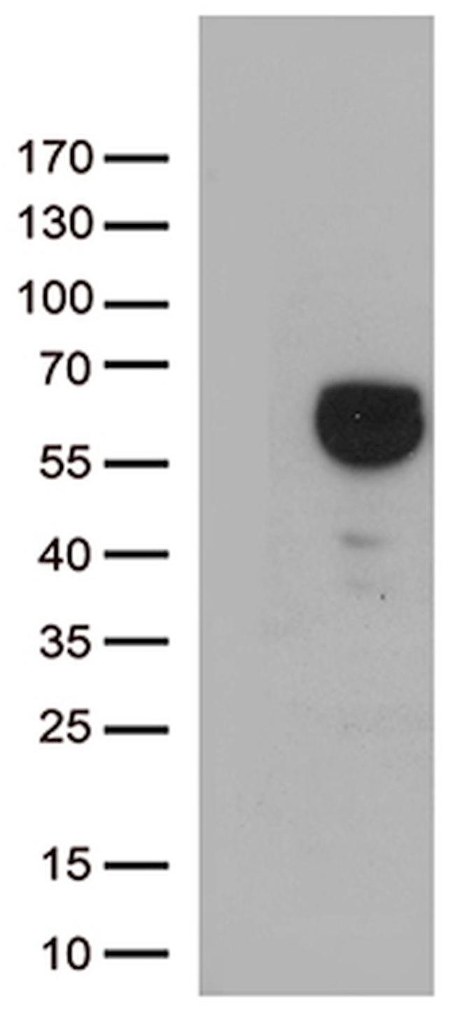 ALDH4A1 Antibody in Western Blot (WB)