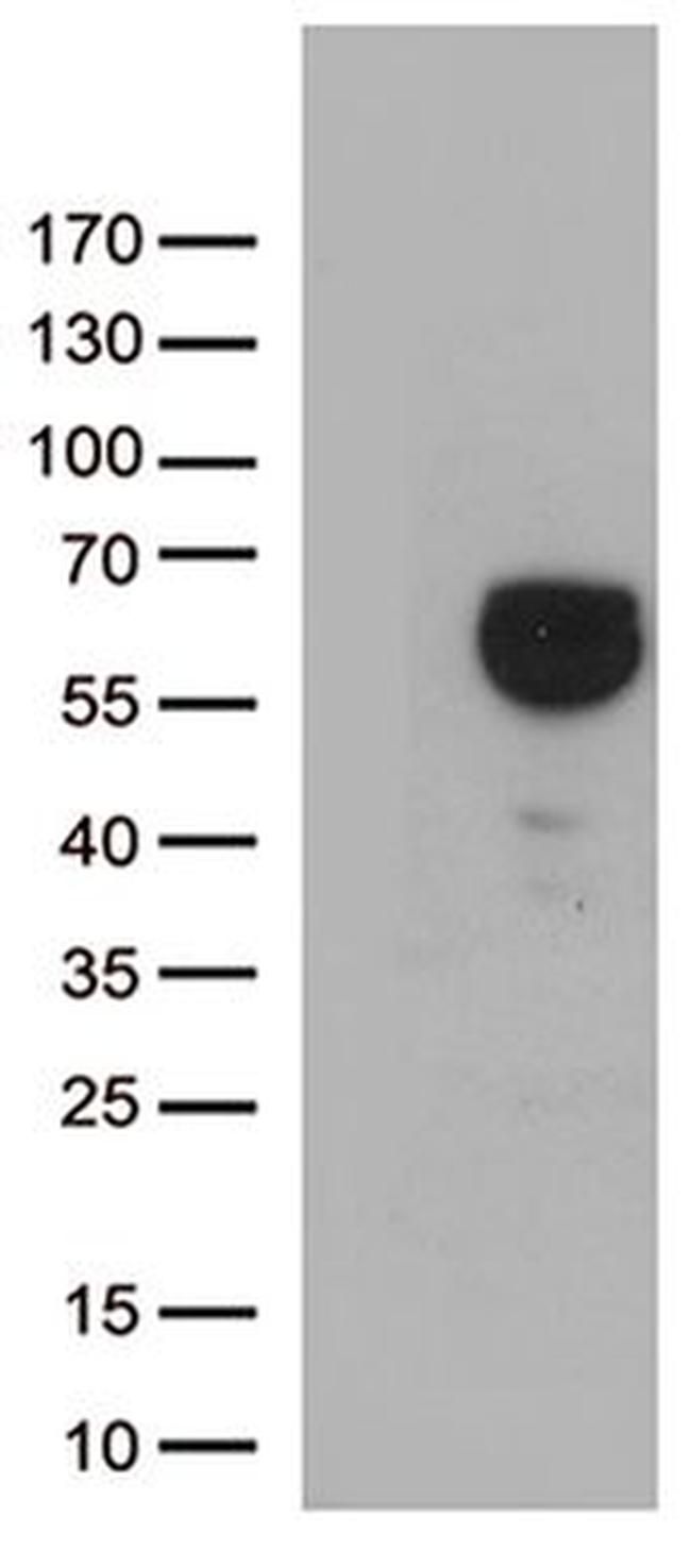 ALDH4A1 Antibody in Western Blot (WB)