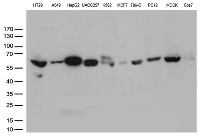 ALDH4A1 Antibody in Western Blot (WB)