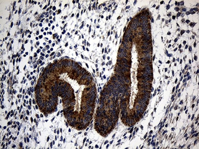 ALDH7A1 Antibody in Immunohistochemistry (Paraffin) (IHC (P))