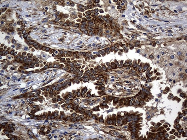 ALDH7A1 Antibody in Immunohistochemistry (Paraffin) (IHC (P))