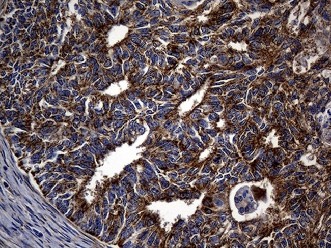 ALDH7A1 Antibody in Immunohistochemistry (Paraffin) (IHC (P))