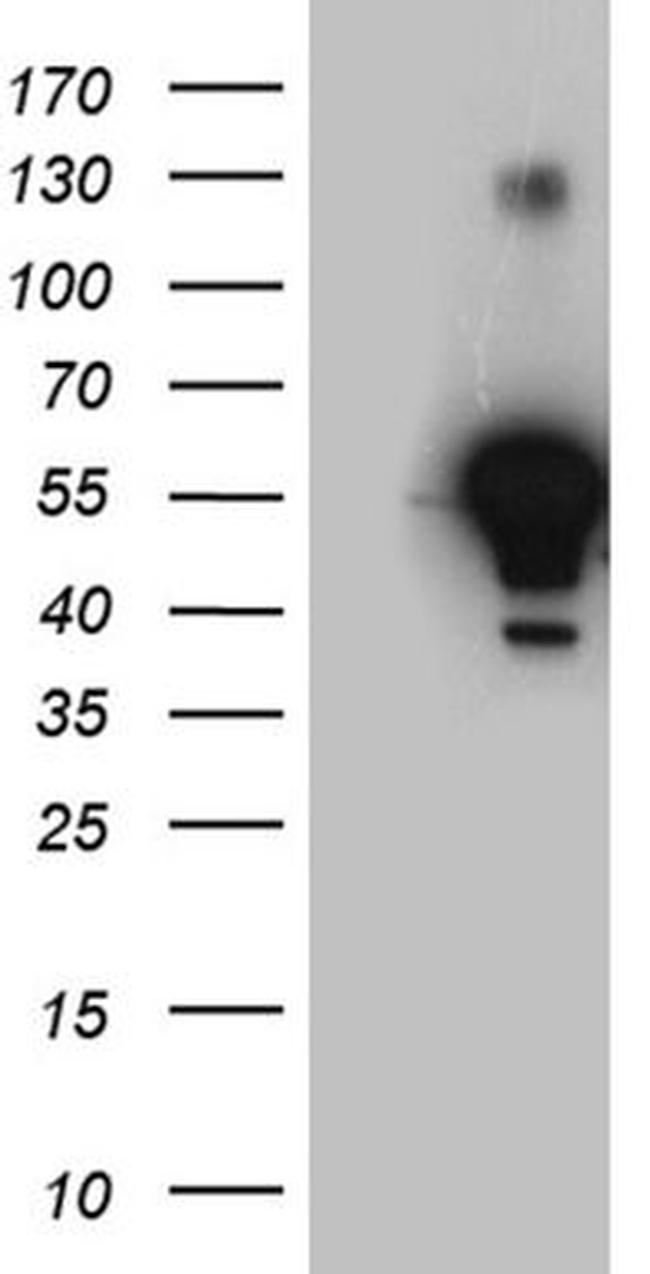 ALDH7A1 Antibody in Western Blot (WB)