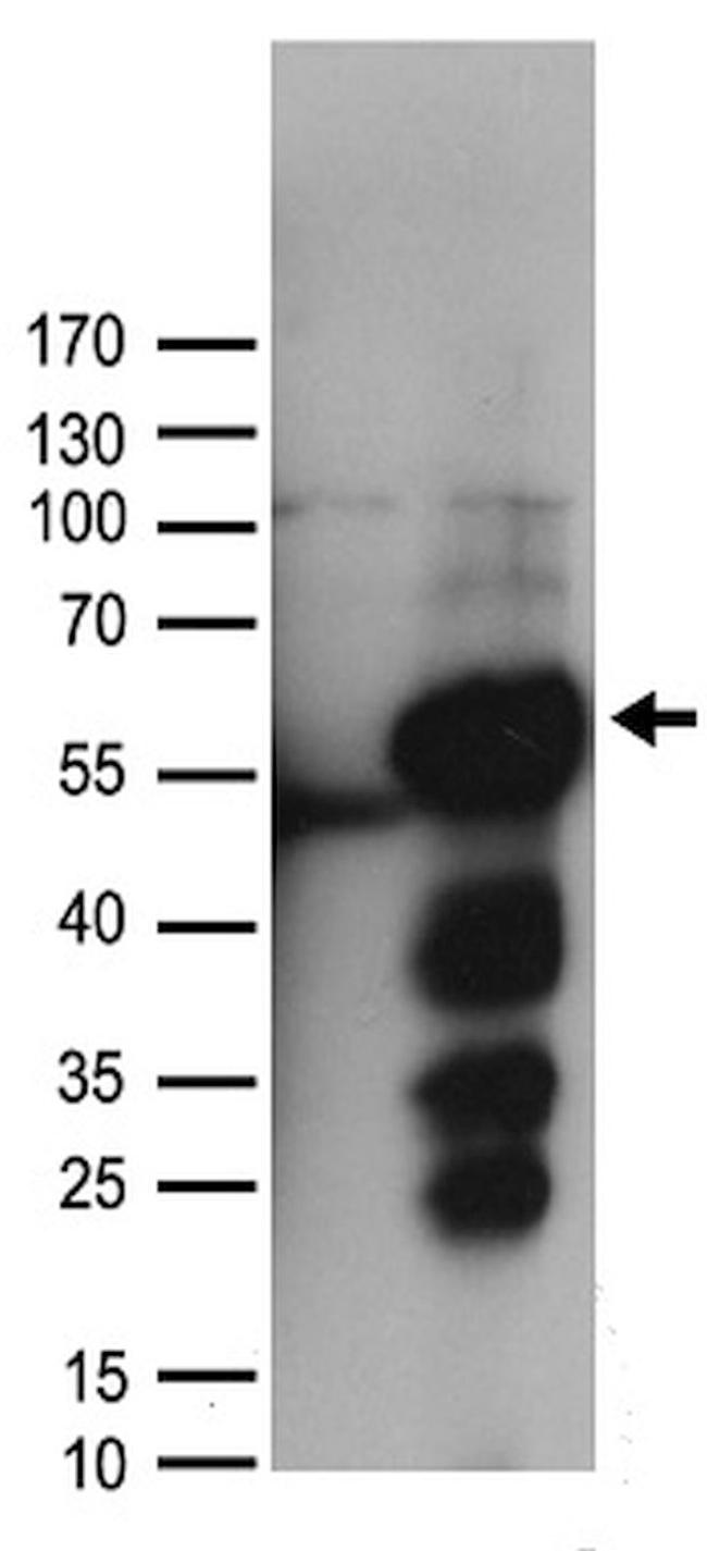 ALDH9A1 Antibody in Western Blot (WB)