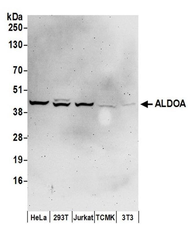 ALDOA Antibody in Western Blot (WB)