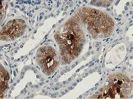 ALDOB Antibody in Immunohistochemistry (Paraffin) (IHC (P))