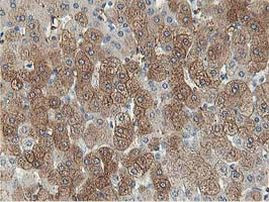 ALDOB Antibody in Immunohistochemistry (Paraffin) (IHC (P))