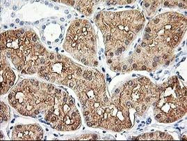 ALDOB Antibody in Immunohistochemistry (Paraffin) (IHC (P))