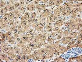 ALDOB Antibody in Immunohistochemistry (Paraffin) (IHC (P))