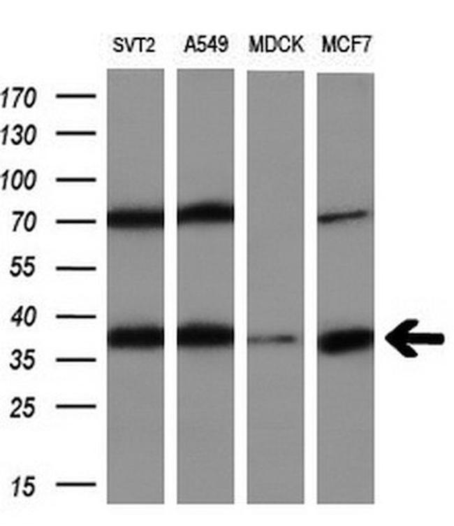 ALDOB Antibody in Western Blot (WB)