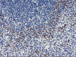 ALG2 Antibody in Immunohistochemistry (Paraffin) (IHC (P))