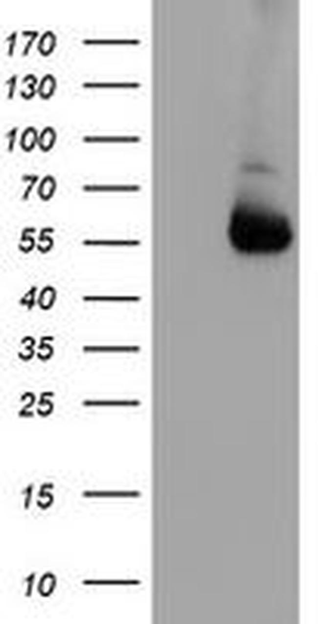 ALG2 Antibody in Western Blot (WB)