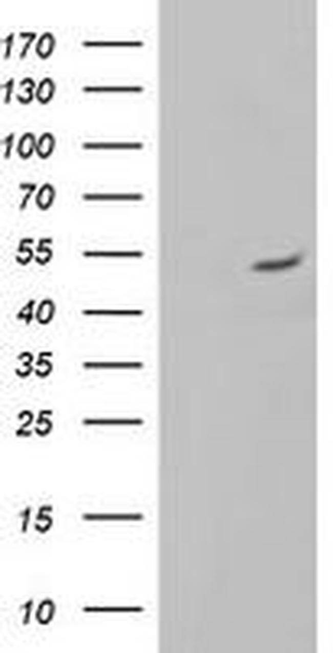 ALG2 Antibody in Western Blot (WB)