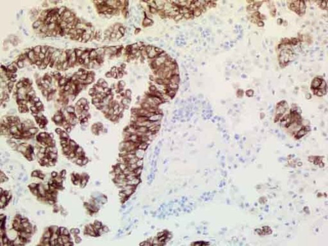 ALK Antibody in Immunohistochemistry (Paraffin) (IHC (P))