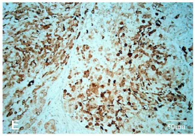 ALK Antibody in Immunohistochemistry (Paraffin) (IHC (P))