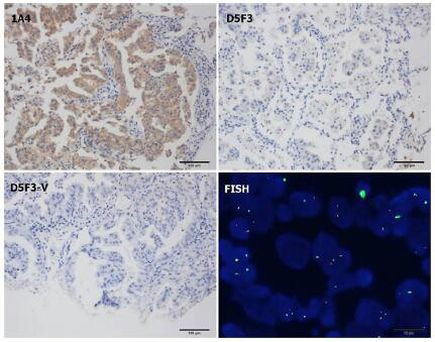 ALK Antibody in Immunohistochemistry (Paraffin) (IHC (P))