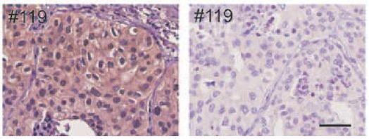 ALK Antibody in Immunohistochemistry (Paraffin) (IHC (P))