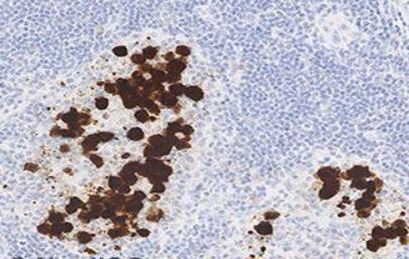 ALK Antibody in Immunohistochemistry (Paraffin) (IHC (P))