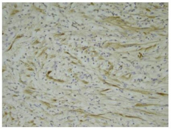 ALK Antibody in Immunohistochemistry (Paraffin) (IHC (P))