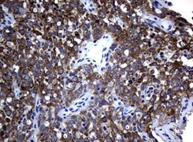 ALK Antibody in Immunohistochemistry (Paraffin) (IHC (P))