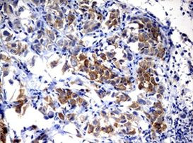 ALK Antibody in Immunohistochemistry (Paraffin) (IHC (P))