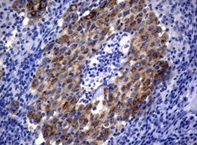 ALK Antibody in Immunohistochemistry (Paraffin) (IHC (P))