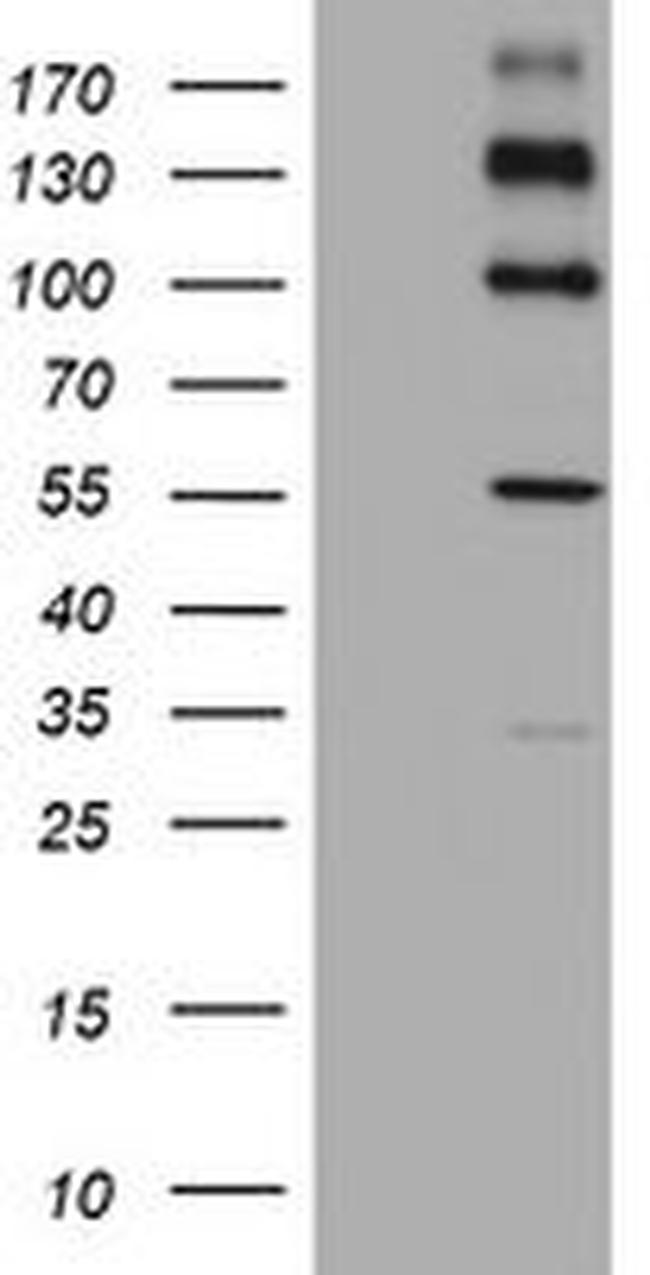 ALK Antibody in Western Blot (WB)