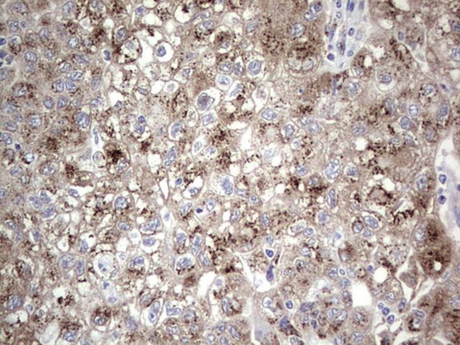 ALKBH1 Antibody in Immunohistochemistry (Paraffin) (IHC (P))