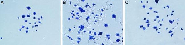 NGF/proNGF Neutralizing Antibody in Neutralization (Neu)