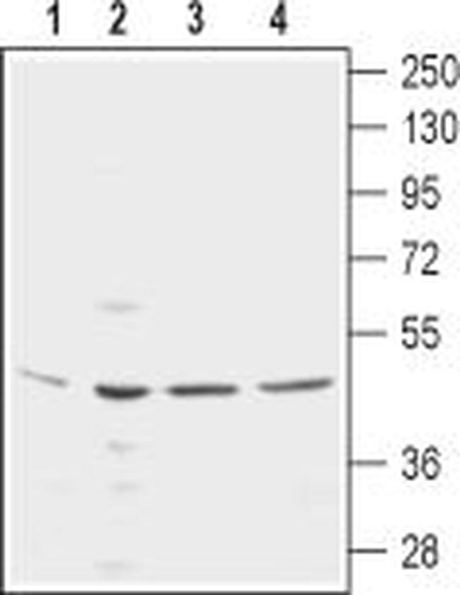 KCNN4 (KCa3.1, SK4) (extracellular) Antibody in Western Blot (WB)