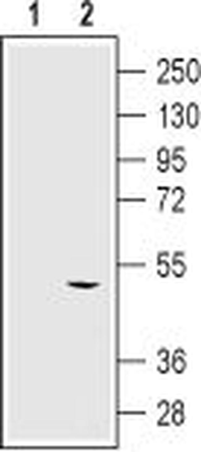 KCNN4 (KCa3.1, SK4) (extracellular) Antibody in Western Blot (WB)