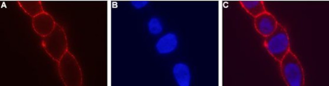 KCNN4 (KCa3.1, SK4) (extracellular) Antibody in Immunocytochemistry (ICC/IF)