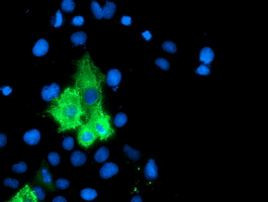 ALOX15 Antibody in Immunocytochemistry (ICC/IF)