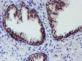 ALOX15 Antibody in Immunohistochemistry (Paraffin) (IHC (P))