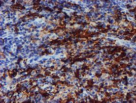 ALOX15 Antibody in Immunohistochemistry (Paraffin) (IHC (P))