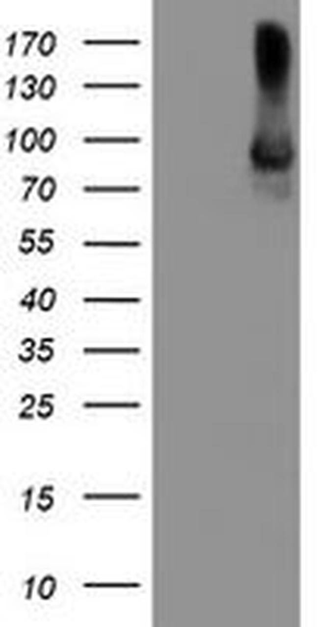 ALOX15 Antibody in Western Blot (WB)