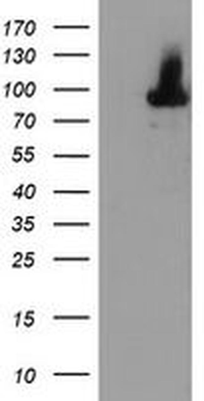 ALOX15 Antibody in Western Blot (WB)