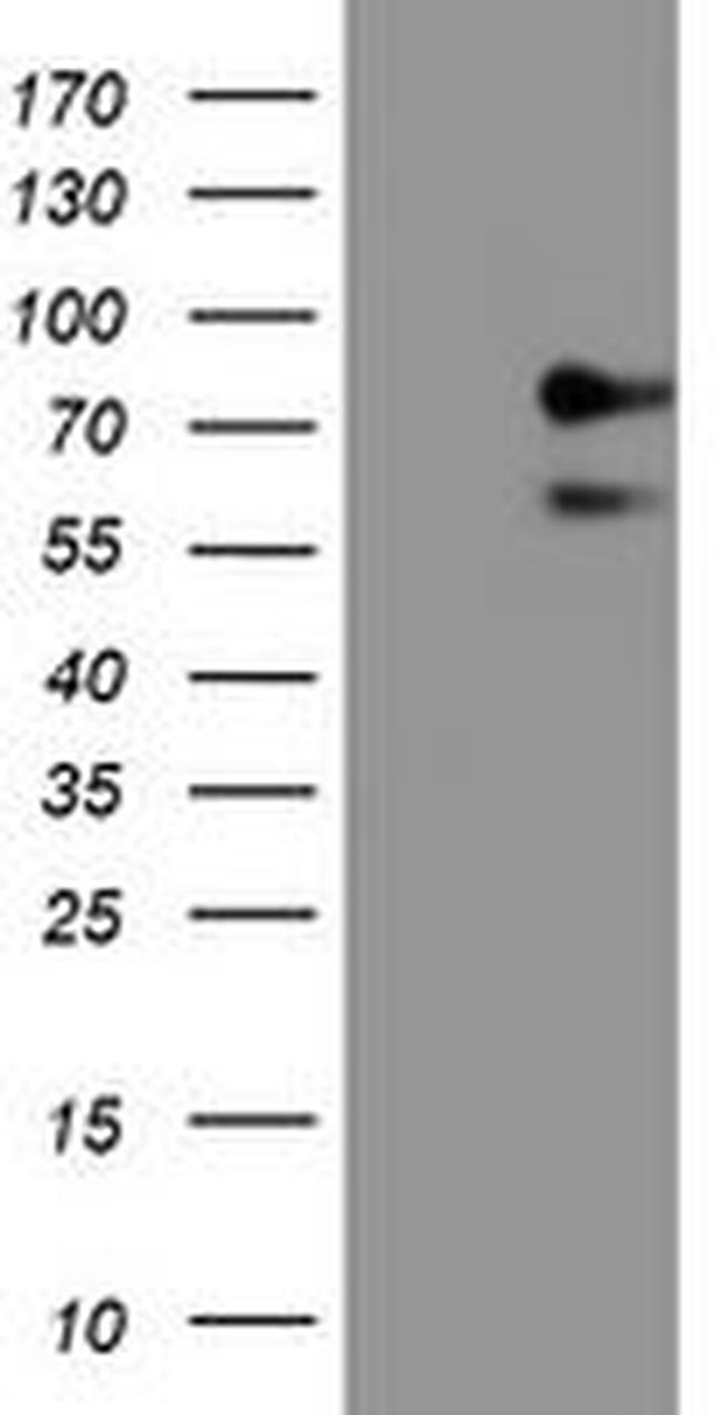 ALOX15 Antibody in Western Blot (WB)