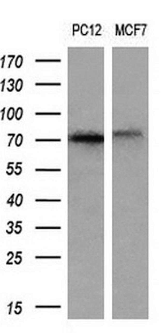 ALOX15 Antibody in Western Blot (WB)