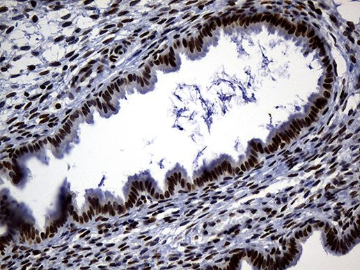 ALOX5 Antibody in Immunohistochemistry (Paraffin) (IHC (P))