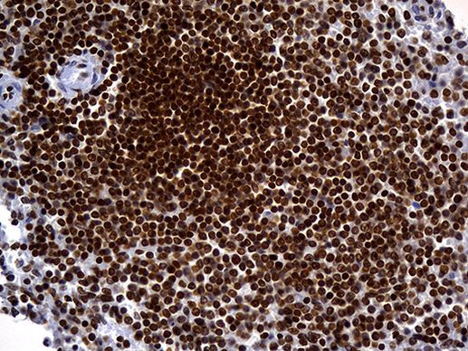 ALOX5 Antibody in Immunohistochemistry (Paraffin) (IHC (P))