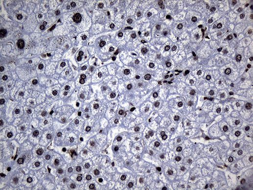 ALOX5 Antibody in Immunohistochemistry (Paraffin) (IHC (P))