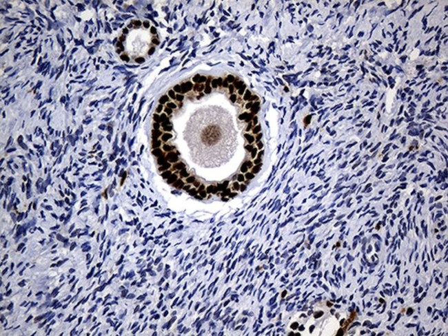 ALOX5 Antibody in Immunohistochemistry (Paraffin) (IHC (P))